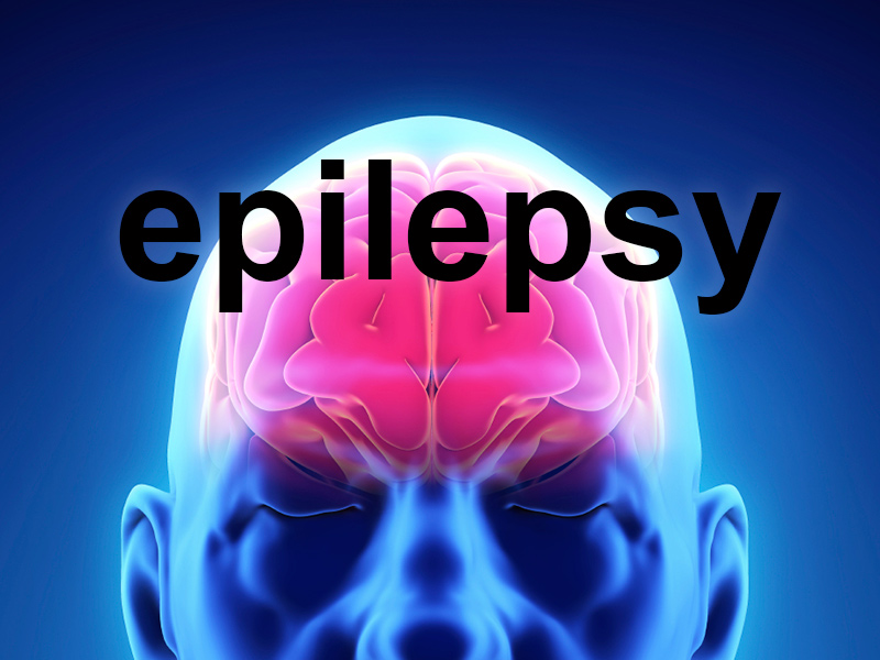 is_151209_brain_epilepsy_800x600